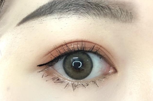 葉秀娣吸脂效果如何？值得一試嗎？