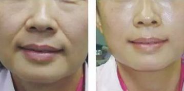青島鼻修復(fù)：頂級專家實力享譽！唇齒相依的實力推薦