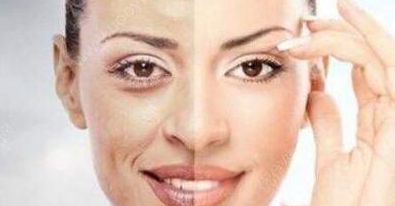 成都賈德淵醫(yī)生的眼睛技術(shù)有何不同？80天變化詳解