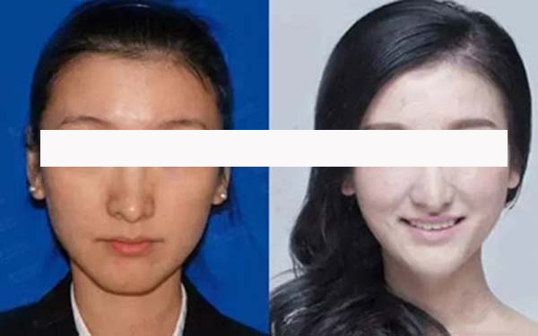 寧波藝星整形和珈禾整形，哪家更具實(shí)力？醫(yī)生口碑、項(xiàng)目擅長和地址公布等方面的對(duì)比如何？