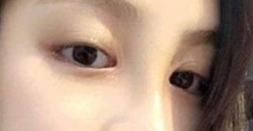如何選擇合適的醫(yī)生，讓你的身材變得完美無暇