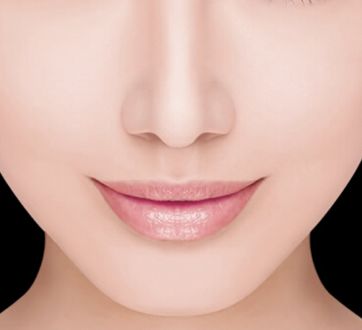 哈醫(yī)大四院李巍主治醫(yī)生鼻整形手術(shù)！80天重塑完美鼻型全記錄！