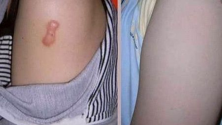 上海知名醫(yī)生手術(shù)CG費用曝光，驚人低價吸引眾多患者！