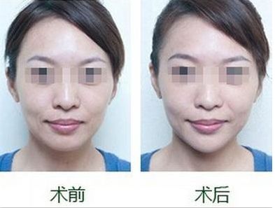 沈陽市的專業(yè)雙眼皮整形醫(yī)院哪家好，排名前三值得信賴