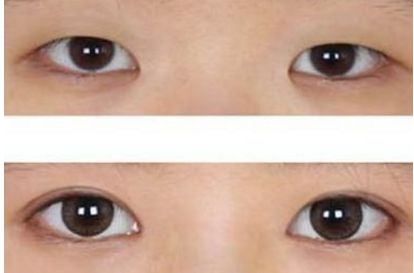 選擇合適的武漢植發(fā)醫(yī)院，看看專家排名和推薦