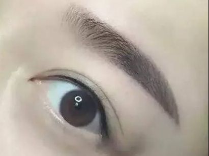 護眼實踐：林琦東如何改善視力？真實案例揭示眼部整形費用