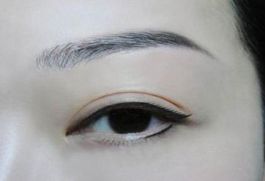 深圳著名眼袋整形專家?guī)湍獯?，鵬程醫(yī)院是否值得選擇？