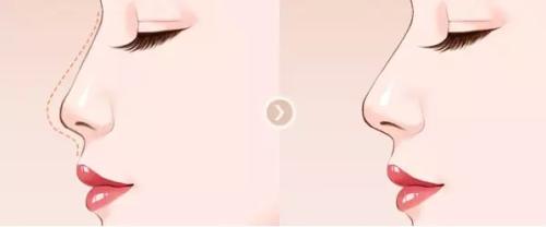 寧波韓美整形吸脂值得信賴(lài)嗎？