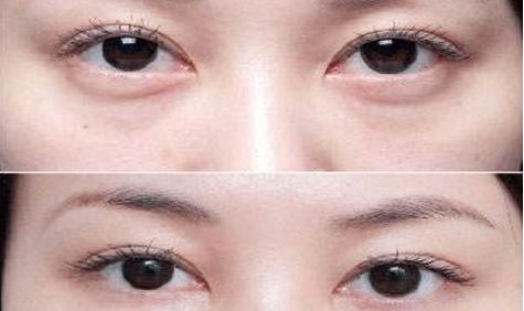 成都眼部整形醫(yī)生高分榜單發(fā)布！這些醫(yī)生哪家強(qiáng)？附詳細(xì)醫(yī)生信息