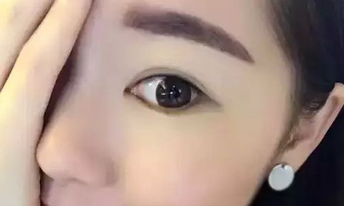 丁世凱教授：看看他的鼻子，醫(yī)生簡介+案例恢復(fù)過程圖參考