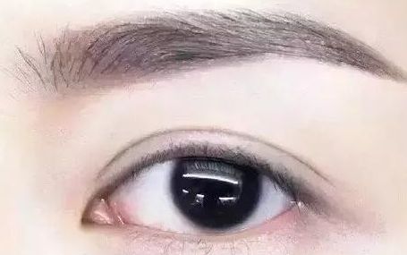 全國(guó)哪位專家值得信賴修復(fù)雙眼皮手術(shù)？頂級(jí)醫(yī)生排行榜首推名單揭曉