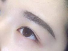 李炳澮醫(yī)生獨(dú)特的技術(shù) 手術(shù)風(fēng)格有何特點(diǎn)？并附帶隆鼻案例分析