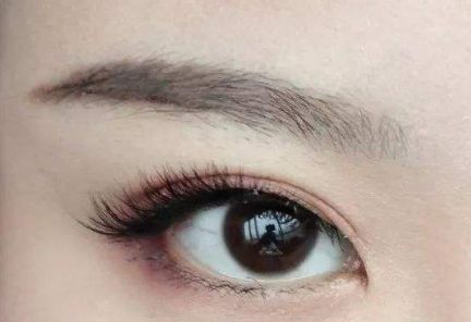 大連王琳雙眼皮的完美實踐，80天親身體驗揭秘