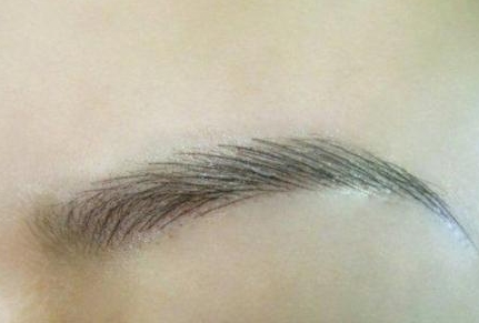 上海九院墊下巴誰的技術(shù)好？魏皎醫(yī)生真人案例和價格均價對比可信嗎？