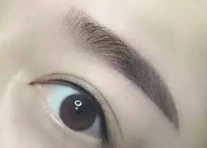 醫(yī)生楊明勇：從技術(shù)實力到用戶評價揭秘，提眉案例評價出乎預料！