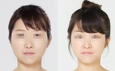 解決口臭問題的有效方法有哪些 解決口臭問題的有效方法有哪些