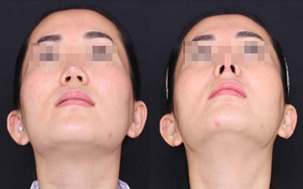 淄博麗人醫(yī)院整形美容科靠譜嗎？有口碑醫(yī)生推薦嗎？