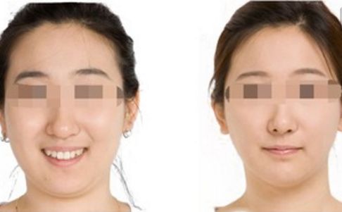 鄭州哪位醫(yī)生在鼻整形領域赫赫有名？口碑出類拔萃的五位專家揭曉！