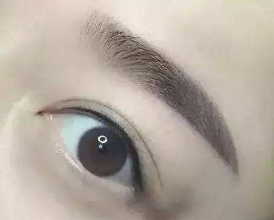 廈門哪家整形醫(yī)院口碑好？專家推薦薇格、中山前三！