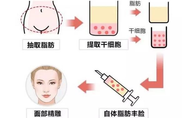 從醫(yī)生個人資料到豐胸案例圖對比，揭秘王沛森的豐胸效果！