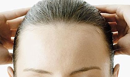 郭建玲雙眼皮修復(fù)費(fèi)用揭秘！看真實(shí)案例圖分享，了解其技術(shù)效果！