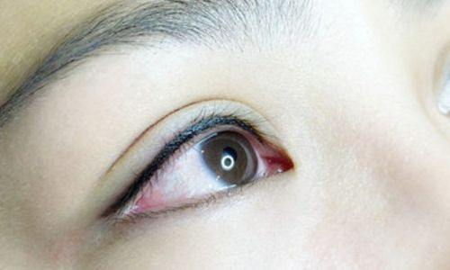 合肥最新星之地整形技術效果如何？魅力煥新，領略面部脂肪填充成功案例