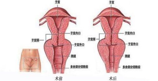上海九院哪里能夠得到專業(yè)的隆鼻手術(shù)？排行榜最新推薦五位頂尖隆鼻專家