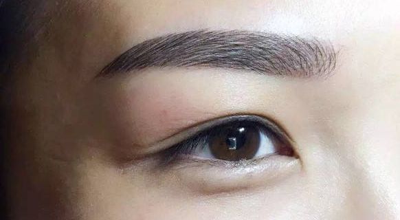 沈陽杏林整形外科醫(yī)院解析鼻部修復(fù)最新技術(shù)，有真實案例展示