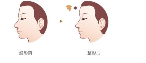 綿陽碧蓮盛植發(fā)醫(yī)院的效果如何？如何查詢地址及醫(yī)生信息？