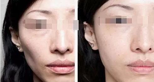 廈門整容醫(yī)院實(shí)力排名揭曉，輕松擁有美麗容顏！