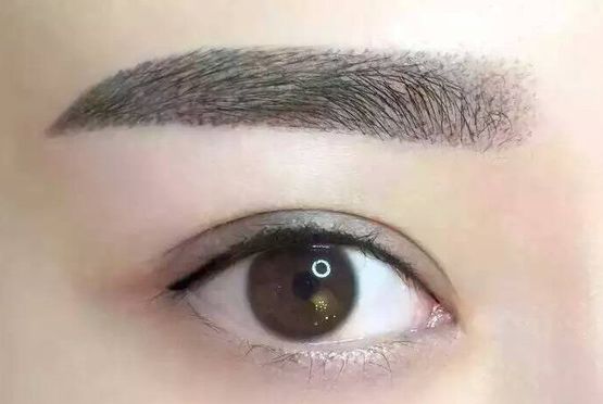 杭州珈禾醫(yī)療美容醫(yī)院激光嫩膚效果及價格表分享