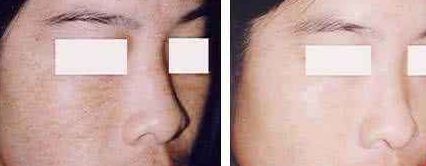 福州美貝爾醫(yī)療美容門診部：薛欣醫(yī)生用戶評價(jià)高？真實(shí)案例分享！