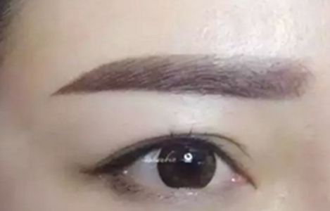 【實(shí)測(cè)】重醫(yī)長(zhǎng)慶和適度眼整：悉心選手，風(fēng)格多元！