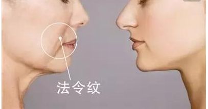 韋元強(qiáng)swan吸脂修復(fù)方法介紹，相關(guān)醫(yī)院推薦