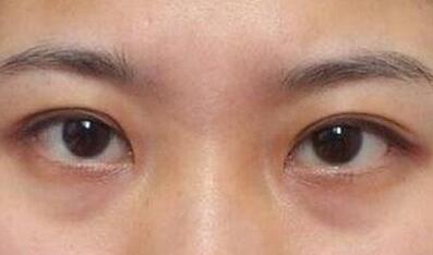 杭州東方整形吸脂到底值不值得嘗試？