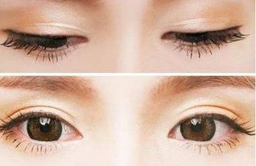 青島壹美天成整形醫(yī)院的隆鼻技術(shù)如何？看看這些真實(shí)案例！