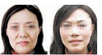 上海九院植發(fā)醫(yī)生口碑榜，收費(fèi)價(jià)格表公開