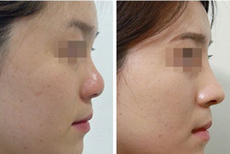 德陽有哪些靠譜的去妊娠紋的醫(yī)院？