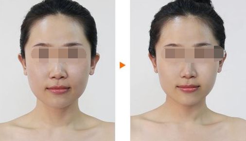 廣州哪家整形醫(yī)院好？排名前十值得推薦
