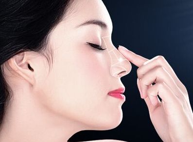 深圳隆鼻哪家好？易培金醫(yī)生經(jīng)驗口碑解析測評
