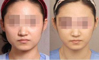 湛江有哪些頂尖整形美容醫(yī)院值得關(guān)注？