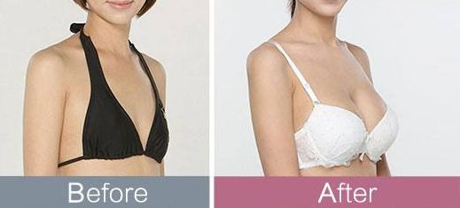 東莞哪家整形醫(yī)院頗受推薦？