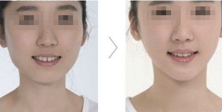 哪家醫(yī)院在北京具有卓越的醫(yī)美科技和服務(wù)？歐洲醫(yī)學(xué)中心、北京協(xié)和、北大人民醫(yī)院等公立單位有何特色？