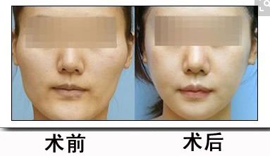 北京醫(yī)院2024年磨骨治療醫(yī)院盤(pán)點(diǎn)