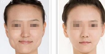 黑龍江三甲整形醫(yī)院熱門榜單，前三強(qiáng)大揭秘！