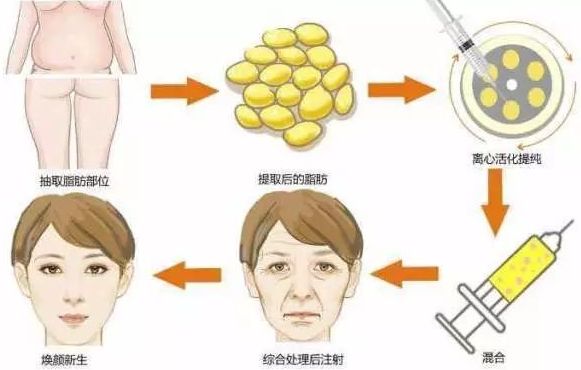 臺州哪家整形美容醫(yī)院效果好？