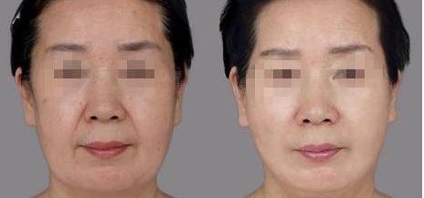樂山哪家整形醫(yī)院雙眼皮比較好？匯總單六強(qiáng)預(yù)測