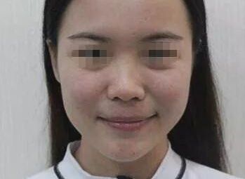 南充疤痕整形醫(yī)院排名精選，助你尋找完美去疤痕之旅