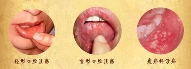 北京眼袋整形醫(yī)院排名大揭秘，最佳去眼袋選擇！