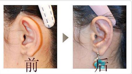 成都友誼醫(yī)院疤痕科：設(shè)備先進、技術(shù)精湛，治療效果如何？